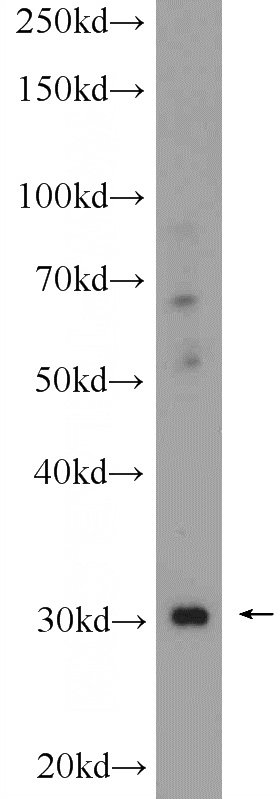 mouse heart tissue were subjected to SDS PAGE followed by western blot with Catalog No:109299(CHST8 Antibody) at dilution of 1:300