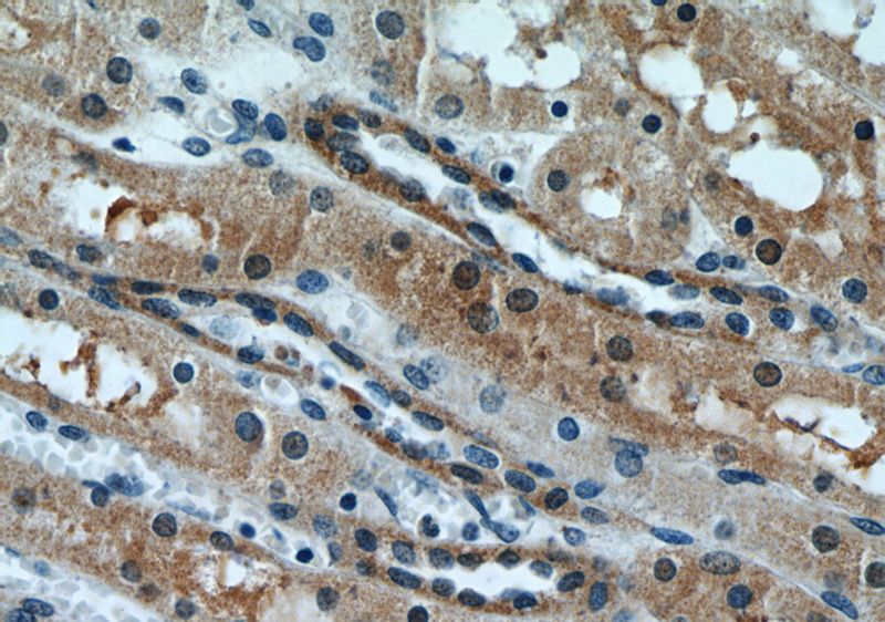 Immunohistochemical of paraffin-embedded human kidney using Catalog No:113774(PFTK1 antibody) at dilution of 1:100 (under 40x lens)