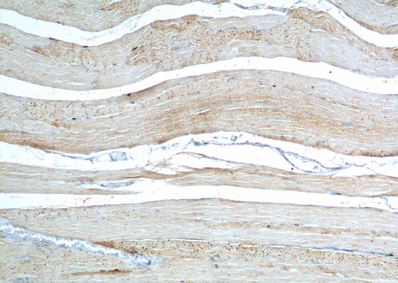 Immunohistochemistry of paraffin-embedded human skeletal muscle tissue slide using Catalog No:117121(BEST3 Antibody) at dilution of 1:200 (under 10x lens).