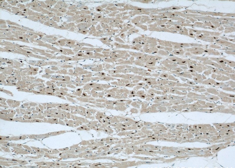 Immunohistochemical of paraffin-embedded human heart using Catalog No:112439(MAPKAP1 antibody) at dilution of 1:50 (under 10x lens)