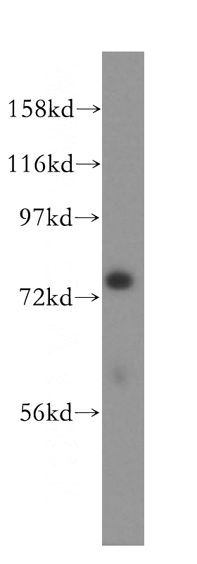 A549 cells were subjected to SDS PAGE followed by western blot with Catalog No:112056(FERMT2 antibody) at dilution of 1:500