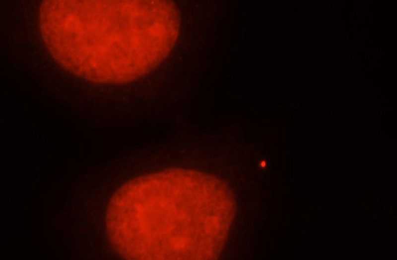 Immunofluorescent analysis of MCF-7 cells, using APEX1 antibody Catalog No:108137 at 1:25 dilution and Rhodamine-labeled goat anti-rabbit IgG (red).