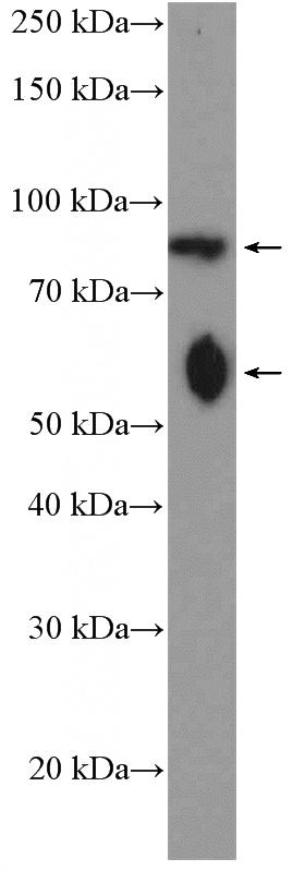 fetal human brain tissue were subjected to SDS PAGE followed by western blot with Catalog No:108612(C17orf28 Antibody) at dilution of 1:1000