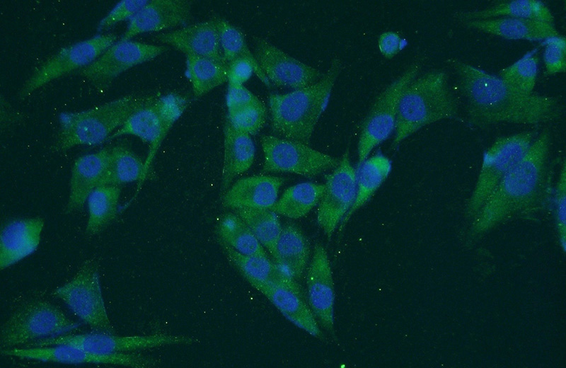 Immunofluorescent analysis of A375 cells using Catalog No:112960(NAT1 Antibody) at dilution of 1:50 and Alexa Fluor 488-congugated AffiniPure Goat Anti-Rabbit IgG(H+L)