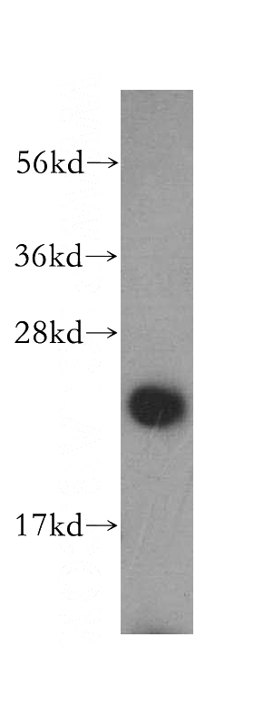 HeLa cells were subjected to SDS PAGE followed by western blot with Catalog No:110041(DTYMK antibody) at dilution of 1:500