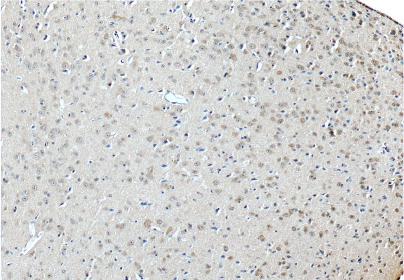 Immunohistochemistry of paraffin-embedded mouse brain tissue slide using Catalog No:111884(JIP1 Antibody) at dilution of 1:50 (under 10x lens)