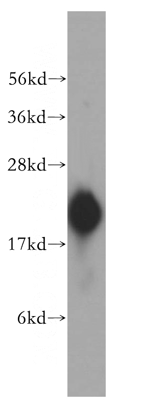 human liver tissue were subjected to SDS PAGE followed by western blot with Catalog No:114681(REEP5 antibody) at dilution of 1:500