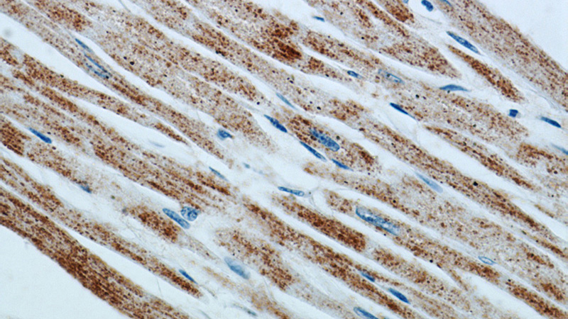 Immunohistochemical of paraffin-embedded human heart using Catalog No:112692(MMADHC antibody) at dilution of 1:50 (under 40x lens)
