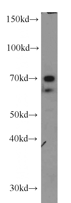 A431 cells were subjected to SDS PAGE followed by western blot with Catalog No:113150(NFIA antibody) at dilution of 1:1000