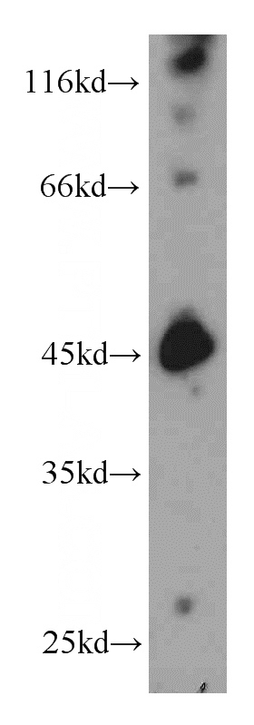 mouse brain tissue were subjected to SDS PAGE followed by western blot with Catalog No:115408(SMYD3 antibody) at dilution of 1:800