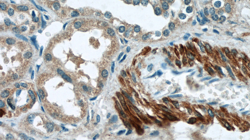 Immunohistochemistry of paraffin-embedded human kidney tissue slide using Catalog No:110551(FBXO28 Antibody) at dilution of 1:50 (under 40x lens)