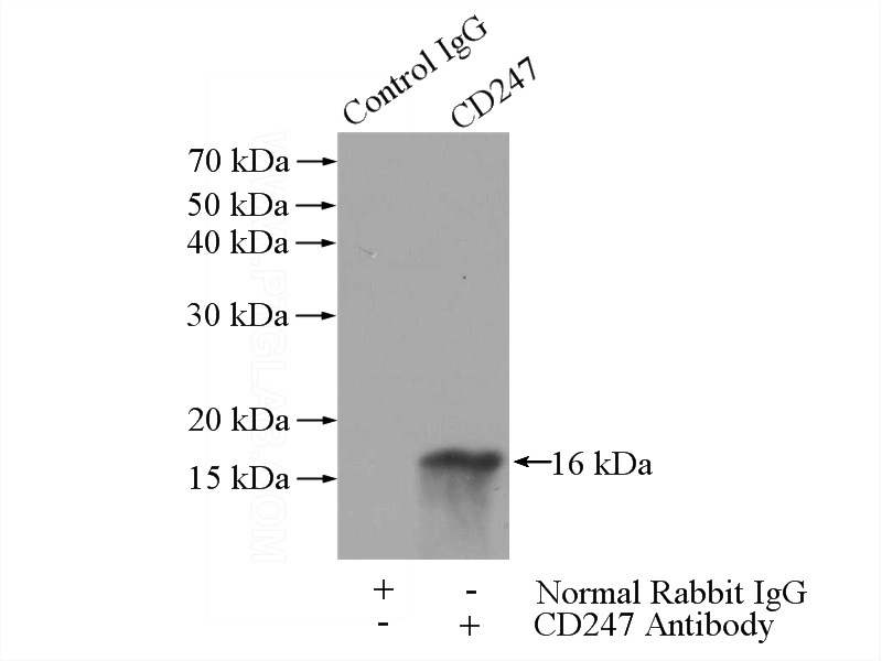 IP Result of anti-CD247 (IP:Catalog No:109015, 3ug; Detection:Catalog No:109015 1:700) with Jurkat cells lysate 1200ug.