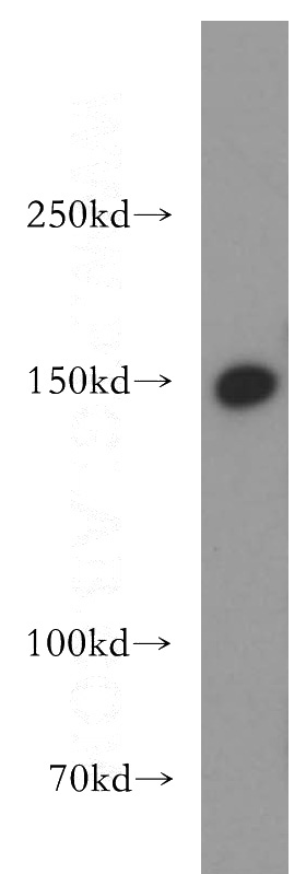 HeLa cells were subjected to SDS PAGE followed by western blot with Catalog No:112146(LARP1 antibody) at dilution of 1:500