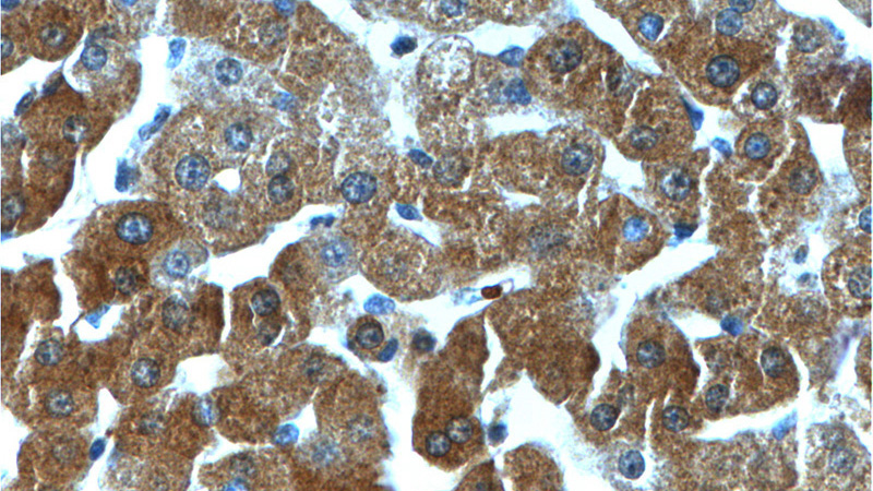 Immunohistochemistry of paraffin-embedded human liver tissue slide using Catalog No:111115(GPR153 Antibody) at dilution of 1:100 (under 40x lens).
