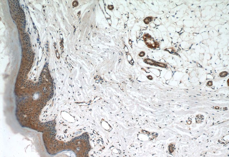Immunohistochemical of paraffin-embedded human skin using Catalog No:112368(MAD2L1BP antibody) at dilution of 1:50 (under 10x lens)