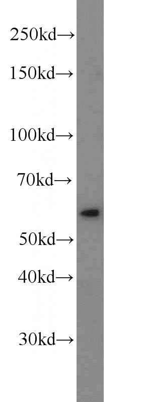 MCF7 cells were subjected to SDS PAGE followed by western blot with Catalog No:113968(PLK1-phospho antibody) at dilution of 1:200