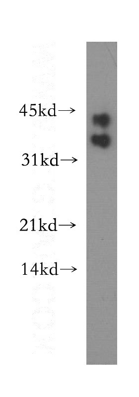 mouse testis tissue were subjected to SDS PAGE followed by western blot with Catalog No:117214(BOLL antibody) at dilution of 1:400