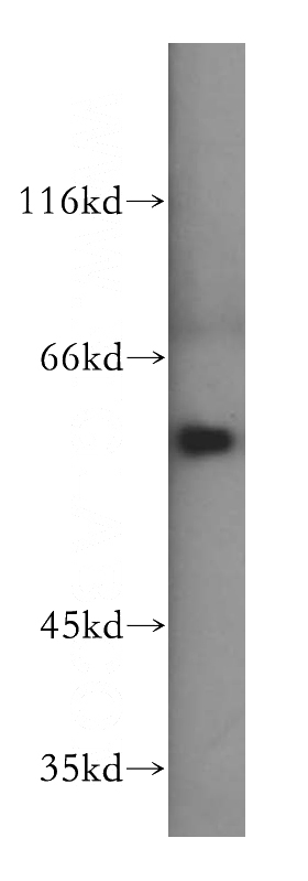 mouse testis tissue were subjected to SDS PAGE followed by western blot with Catalog No:111372(HDAC1-specific antibody) at dilution of 1:500