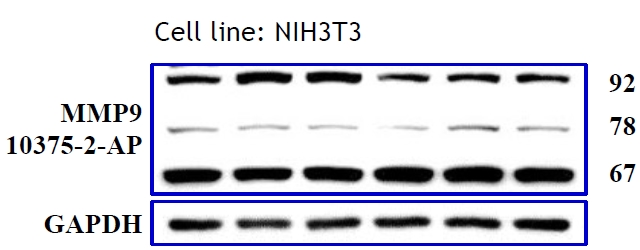 WB results of MMP9 antibody (Catalog No:112709, 1:500) with NIH3T3 cells, 92 kDa for pro-MMP9 and 78-82 kDa and 67 kDa for Active MMP9. Data from Dr. Hui-Wen Chiu, Taipei Medical University.