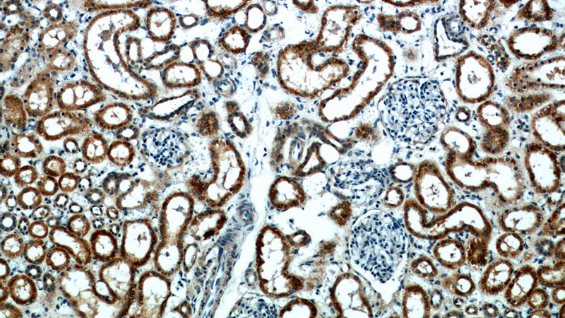 Immunohistochemical of paraffin-embedded human kidney using Catalog No:108371(BBS4 antibody) at dilution of 1:50 (under 10x lens)