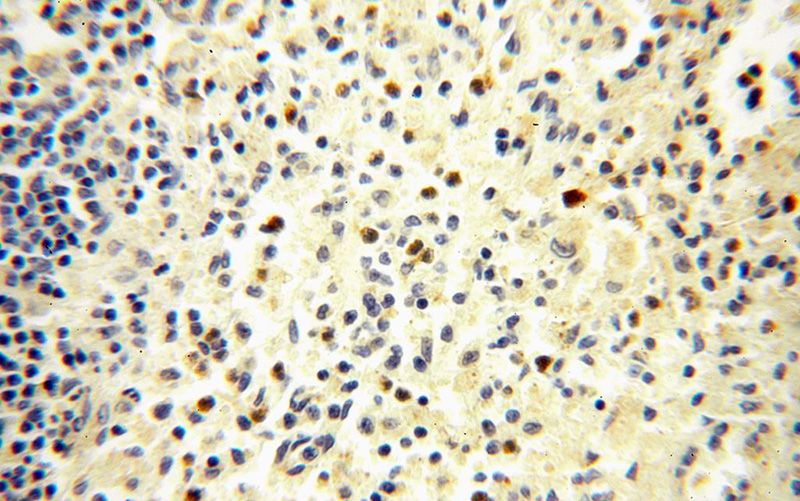 Immunohistochemical of paraffin-embedded human spleen using Catalog No:116573(UNC13D antibody) at dilution of 1:100 (under 40x lens)
