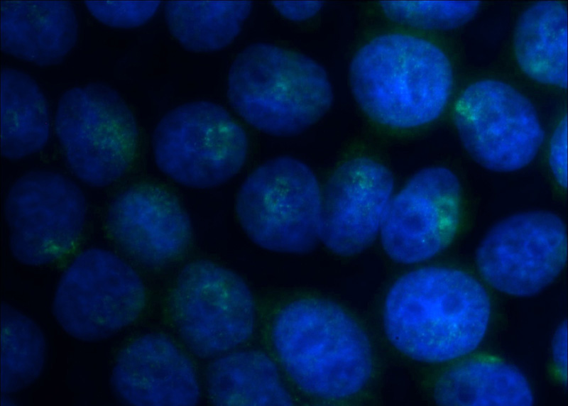 Immunofluorescent analysis of MCF-7 cells using Catalog No:108361(Barkor-Specific Antibody) at dilution of 1:25 and Alexa Fluor 488-congugated AffiniPure Goat Anti-Rabbit IgG(H+L)