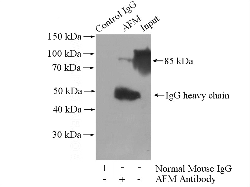 IP Result of anti-AFM (IP:Catalog No:107562, 5ug; Detection:Catalog No:107562 1:500) with human plasma tissue lysate 4000ug.