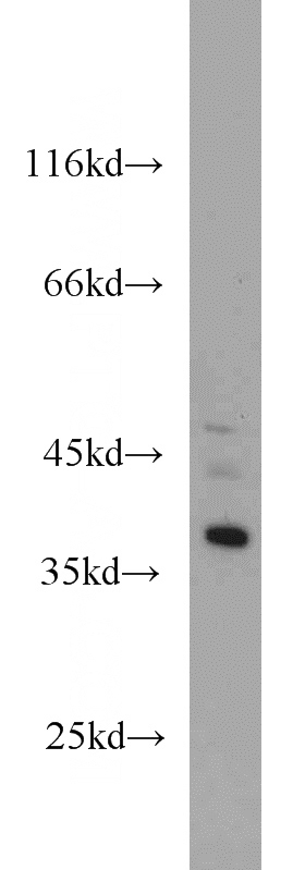 mouse brain tissue were subjected to SDS PAGE followed by western blot with Catalog No:110873(GAS7 antibody) at dilution of 1:1000