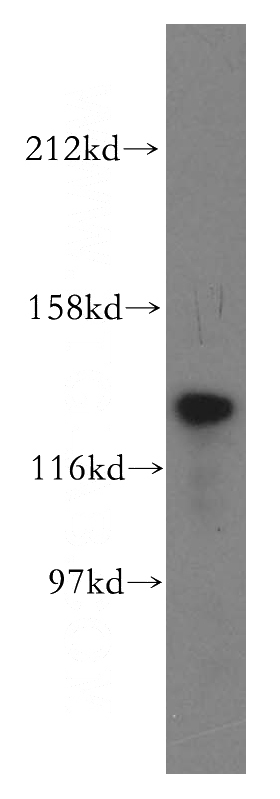 A2780 cells were subjected to SDS PAGE followed by western blot with Catalog No:116477(TTF2 antibody) at dilution of 1:500