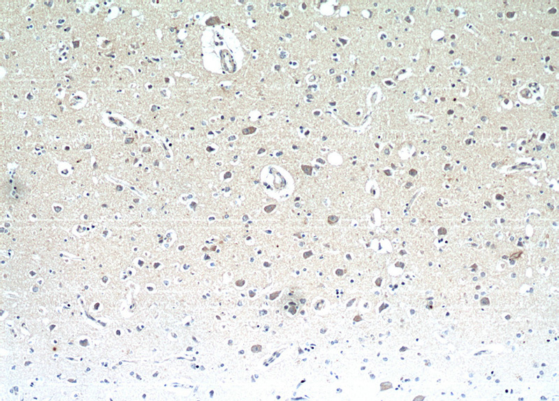 Immunohistochemical of paraffin-embedded human brain using Catalog No:113130(NMB antibody) at dilution of 1:25 (under 10x lens)
