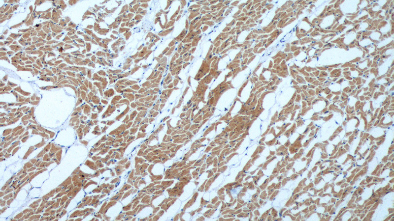 Immunohistochemistry of paraffin-embedded human heart tissue slide using Catalog No:107315(MYL3 Antibody) at dilution of 1:600 (under 10x lens).