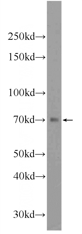 mouse kidney tissue were subjected to SDS PAGE followed by western blot with Catalog No:115170(SLC5A4 Antibody) at dilution of 1:1000