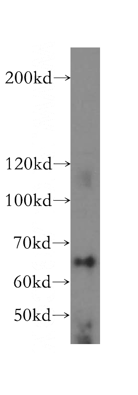 HeLa cells were subjected to SDS PAGE followed by western blot with Catalog No:112148(LARP7 antibody) at dilution of 1:500
