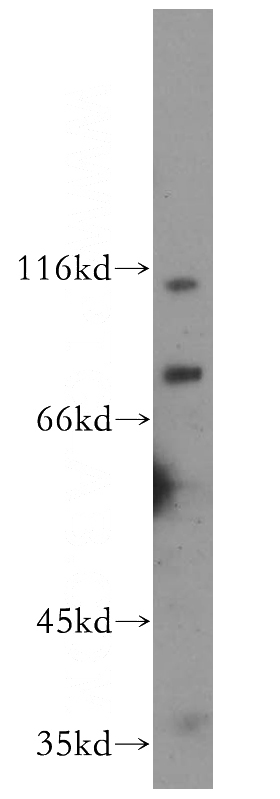 HeLa cells were subjected to SDS PAGE followed by western blot with Catalog No:117237(BRIT1 antibody) at dilution of 1:500