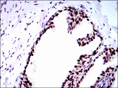 Immunohistochemical analysis of paraffin-embedded prostate tissues using RPA1 mouse mAb with DAB staining.