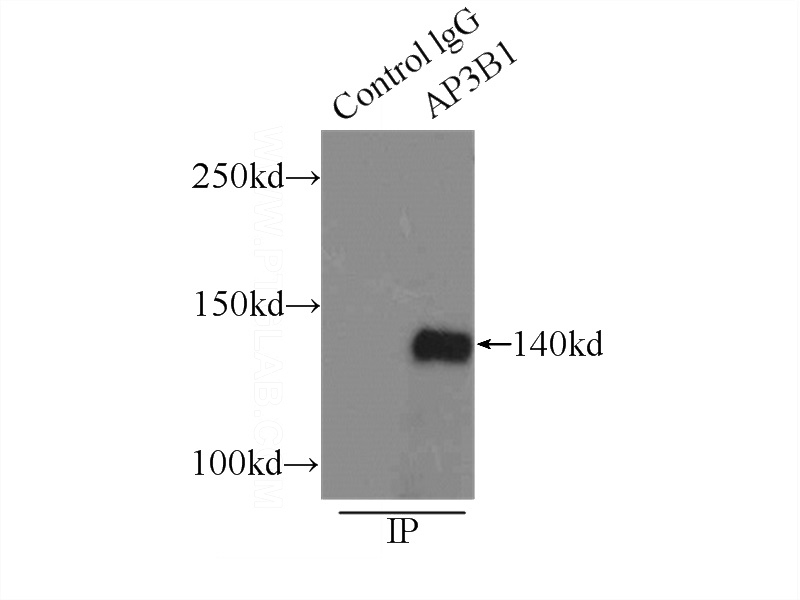 IP Result of anti-AP3B1 (IP:Catalog No:108121, 3ug; Detection:Catalog No:108121 1:500) with COLO 320 cells lysate 2500ug.