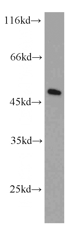 HeLa cells were subjected to SDS PAGE followed by western blot with Catalog No:110258(EIF4A3 antibody) at dilution of 1:1000