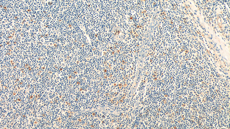 Immunohistochemistry of paraffin-embedded human tonsillitis tissue slide using Catalog No:109014(CD244 Antibody) at dilution of 1:50 (under 10x lens)