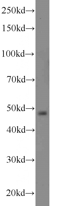 HeLa cells were subjected to SDS PAGE followed by western blot with Catalog No:113480(PACSIN3 antibody) at dilution of 1:1000