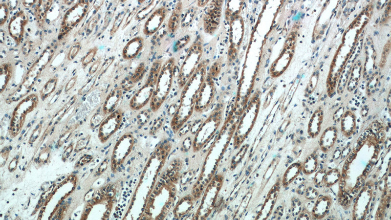 Immunohistochemistry of paraffin-embedded human kidney tissue slide using Catalog No:115010(SCNN1A Antibody) at dilution of 1:50 (under 10x lens)
