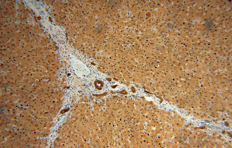 Immunohistochemical of paraffin-embedded human liver using Catalog No:115677(STARD10 antibody) at dilution of 1:100 (under 10x lens)