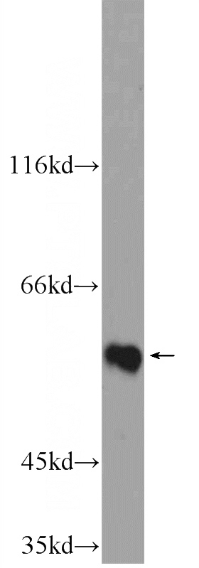 HL-60 cells were subjected to SDS PAGE followed by western blot with Catalog No:117016(ZNF649 Antibody) at dilution of 1:300