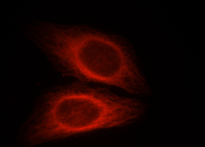 Immunofluorescent analysis of HepG2 cells, using CXCR7 antibody Catalog No:109646 at 1:25 dilution and Rhodamine-labeled goat anti-rabbit IgG (red).