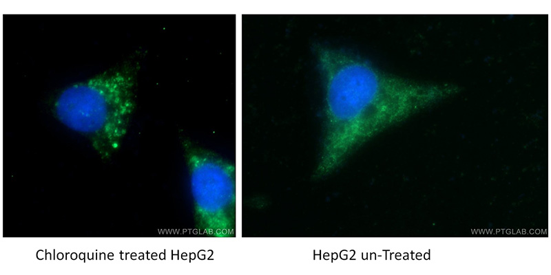 Immunofluorescent analysis of Chloroquine treated/untreated HepG2 cells using Catalog No:112166 (LC3B-Specific Antibody) at dilution of 1:50 and Alexa Fluor 488-congugated AffiniPure Goat Anti-Rabbit IgG(H+L). Cells were fixed with ethanol at -20 oc.