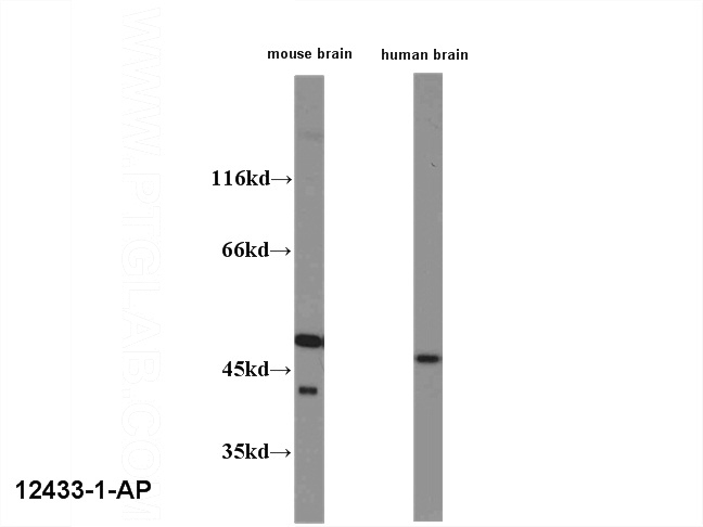 WB result of anti-HOMER1 (Catalog No:) with mouse brain lysate and human brain lysate.