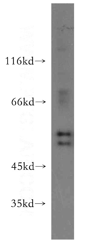 HT-1080 cells were subjected to SDS PAGE followed by western blot with Catalog No:111468(HS1BP3 antibody) at dilution of 1:100