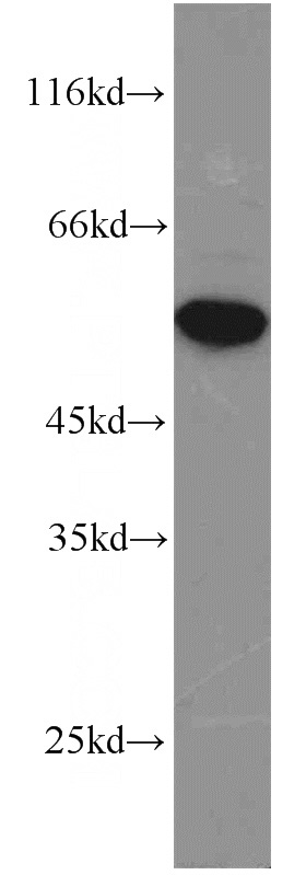HeLa cells were subjected to SDS PAGE followed by western blot with Catalog No:110711(FOXP3 antibody) at dilution of 1:2000