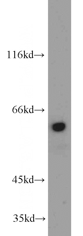 HL-60 cells were subjected to SDS PAGE followed by western blot with Catalog No:116390(TRIP4 antibody) at dilution of 1:1000