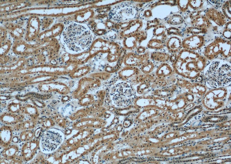 Immunohistochemical of paraffin-embedded human kidney using Catalog No:111846(INPP5K antibody) at dilution of 1:50 (under 10x lens)
