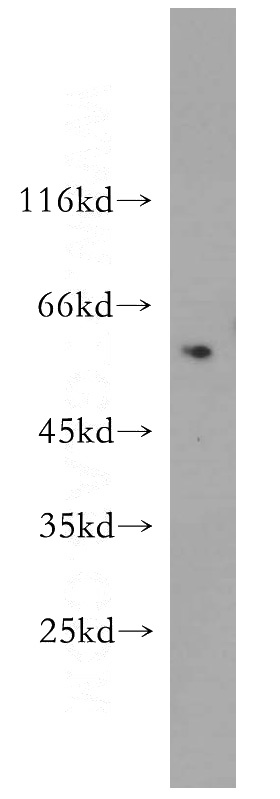 SGC-7901 cells were subjected to SDS PAGE followed by western blot with Catalog No:112924(MYEOV antibody) at dilution of 1:400